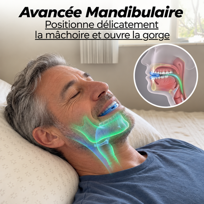 Embout buccal anti-ronflement Serena®
